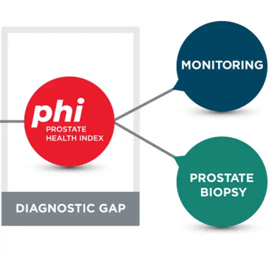 prostate health index (phi) test